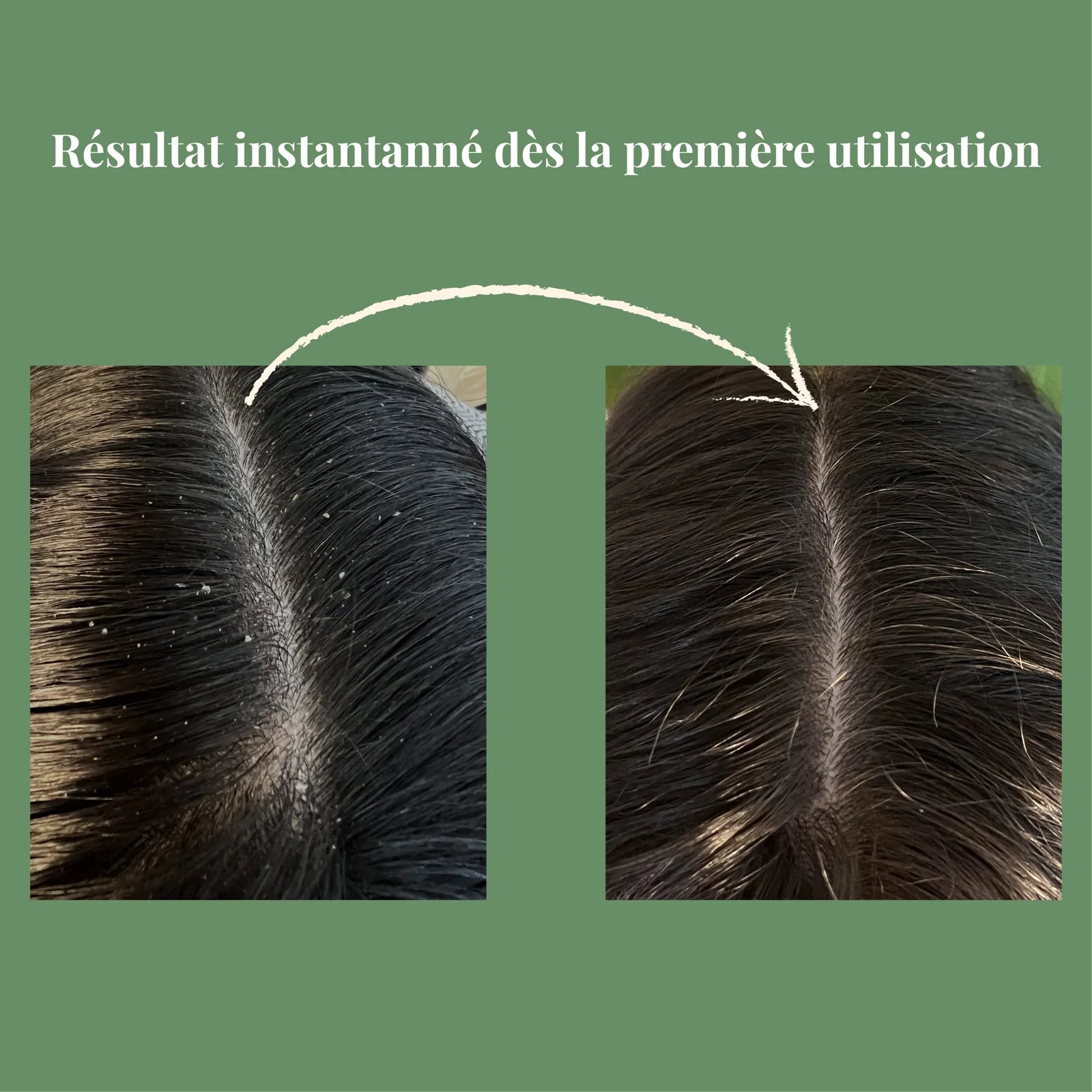 Avant et après la brosse : la raie dégagée des squames, dès la première utilisation